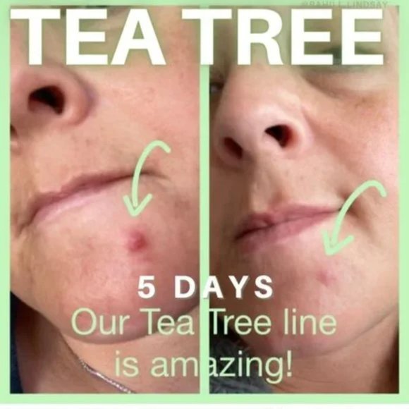 Dr. C. Tuna Tea Tree Face Cream NIP - Picture 7 of 7